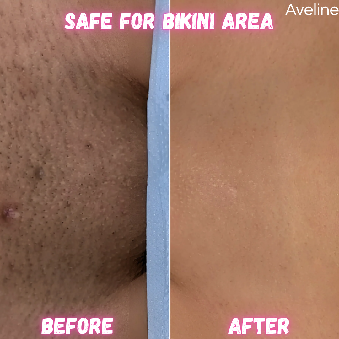 SmoothTrim - 2-in-1 Bikini & Body Trimmer