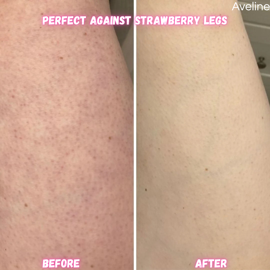 SmoothTrim - 2-in-1 Bikini & Body Trimmer